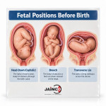 Fetal Positions Before Birth